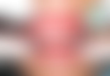 Fístulas. O que são, como surgem e qual o tratamento adequado.