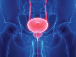 Understanding Prostate Cancer