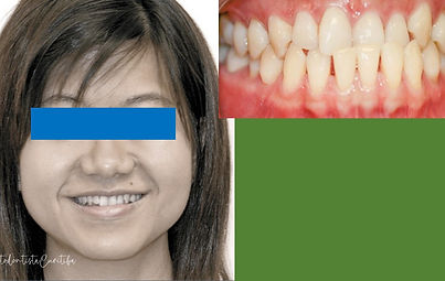 Tratamentos & Depoimentos | Ortodontia | OrtodontistaCuritiba | Centro Cívico | Curitiba