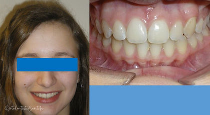 Tratamentos & Depoimentos | Ortodontia | OrtodontistaCuritiba | Centro Cívico | Curitiba