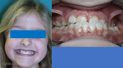 Tratamentos & Depoimentos | Ortodontia | OrtodontistaCuritiba | Centro Cívico | Curitiba