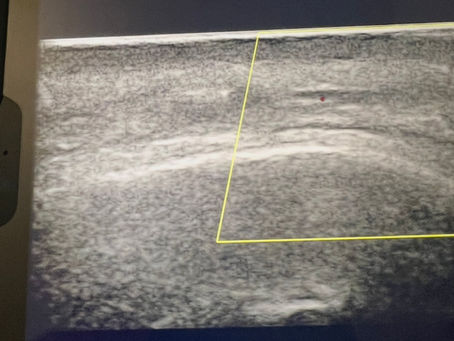 Scalp Ultrasound in Hair Loss Medicine: Why I Routinely Use Ultra High-Frequency Imaging in Alopecia Assessment