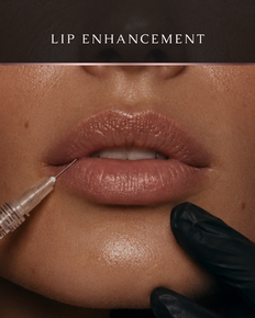 Natural-looking lip enhancement treatment improving lip shape, hydration, symmetry, and definition in Ottawa and Kingston.