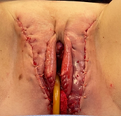 postop.heic