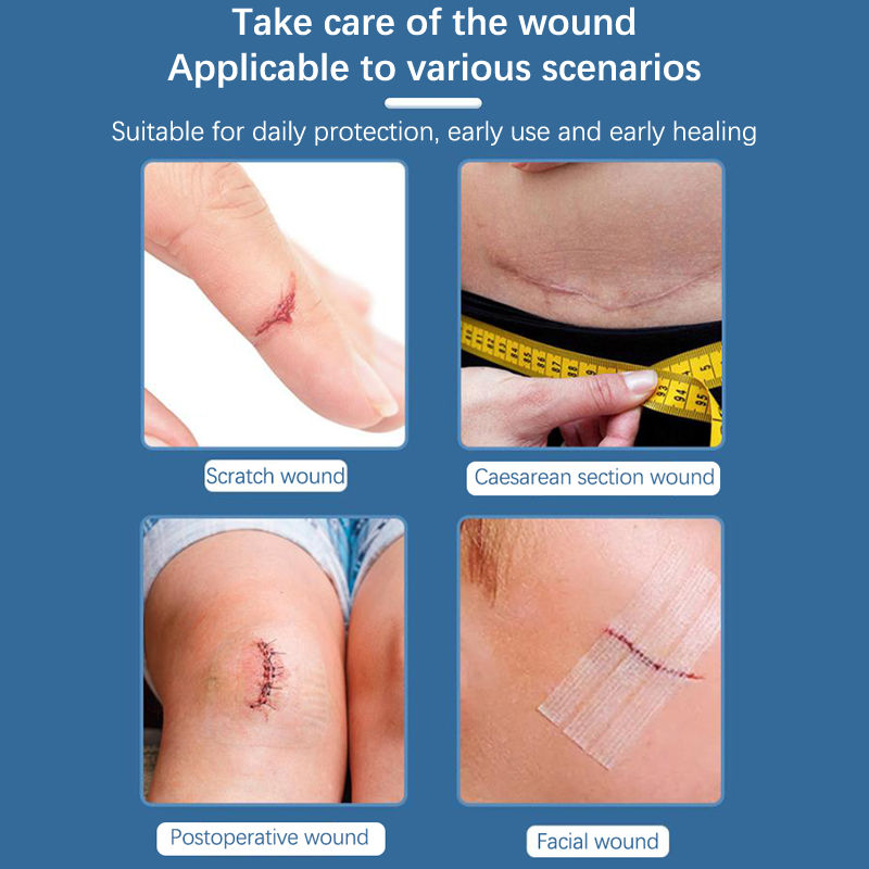 Thumbnail: 2/3/5 Strip Wound Closure Tape Adhesive Sterile Medical Bandage Strip Skin Repai