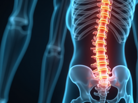 Understanding Slipped Discs: The Hidden Impacts and Strategies for Effective Management