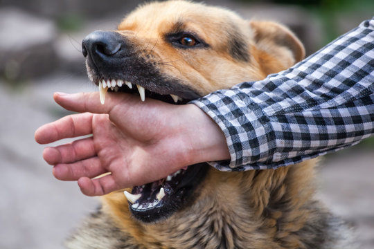 dog biting person