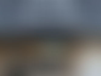 Non-Surgical Hair Restoration Thibodaux: Everything You Need To Know