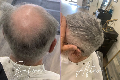 Wilma Gros Hair Loss Expert Silk Press hair loss for MEN