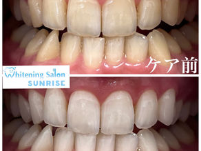 ビフォアーアフター