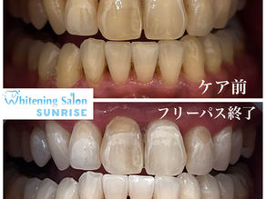 ビフォアーアフター