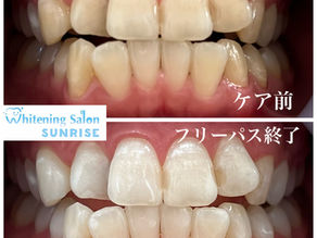 ビフォアーアフター