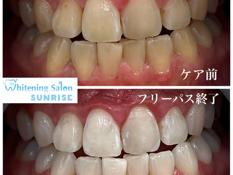 ビフォアーアフター