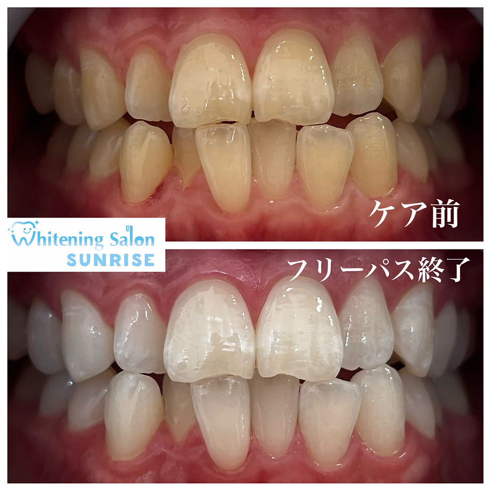 ビフォアーアフター