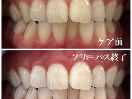 ビフォアーアフター