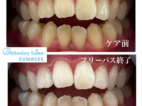 ビフォアーアフター