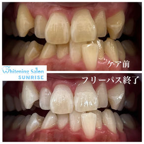 ビフォアーアフター