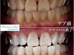 ビフォアーアフター