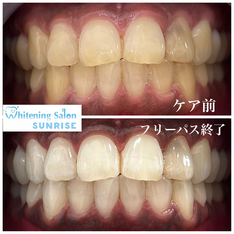 ビフォアーアフター