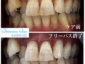 ビフォアーアフター