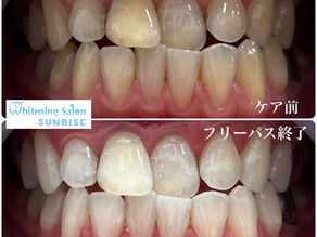 ビフォアーアフター