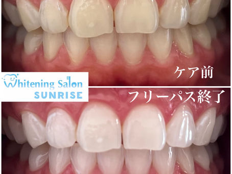 ビフォアーアフター