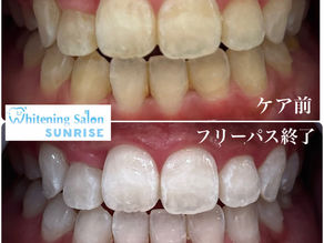 ビフォアーアフター