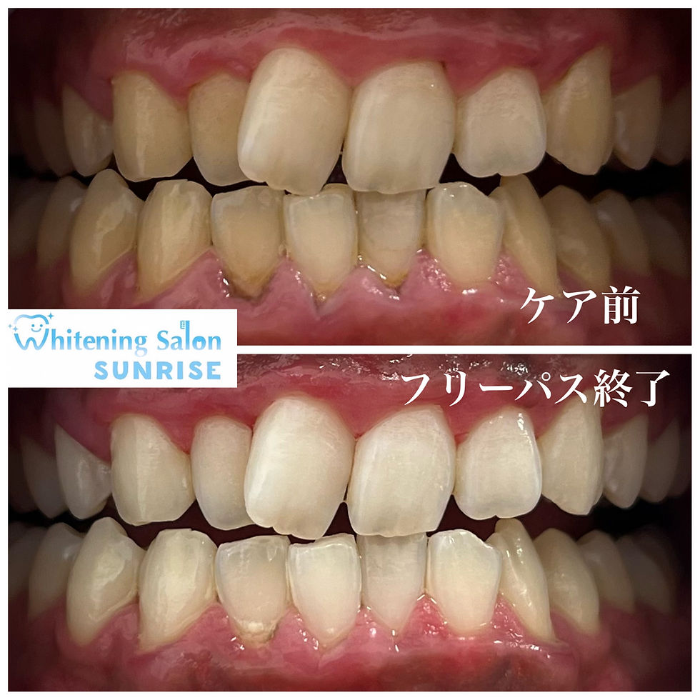 ビフォアーアフター