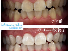 ビフォアーアフター