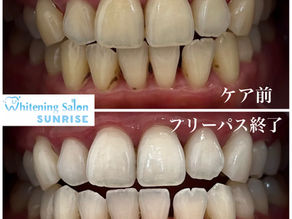 ビフォアーアフター