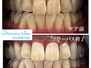 ビフォアーアフター