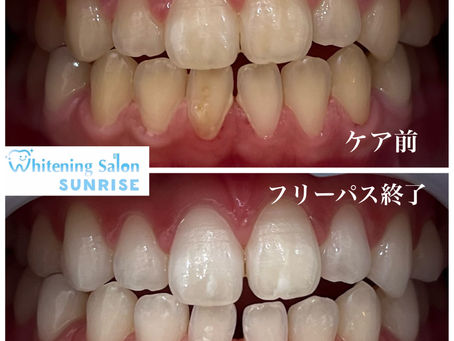 ビフォアーアフター