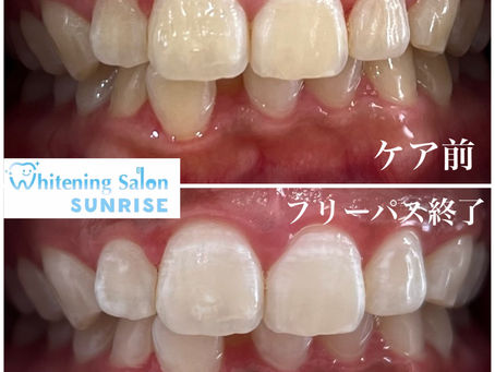 ビフォアーアフター