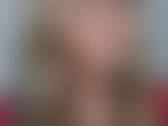 Parasitic worm moved around woman's face