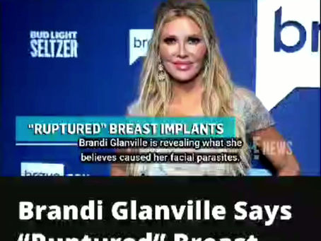 BRANDI GLANVILLE: "I GOT FACE PARASITE FROM BOOB JOB”