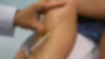 Varices