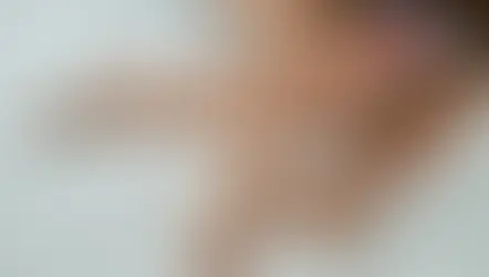 성노동자, 일반인보다 ‘성병’ 감염률 낮아