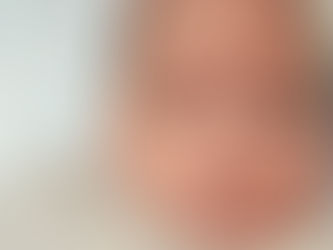 약물사고, 성인 복용량 투여 받은 ‘두 달 된 영아 사망’