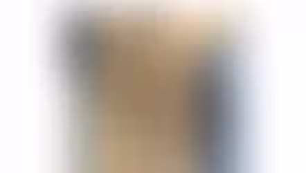 “닭고기와 비스킷만 먹던 5세 아동”…‘괴혈병’ 진단