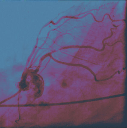 black_white_vessels colored.jpg