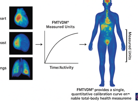 The Global Transition to Total Body FMTVDM: From Specialized Imaging to Comprehensive National Health Platforms