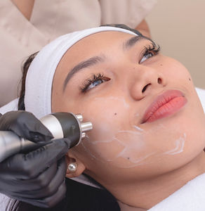 radiofrequence visage collagene .jpg