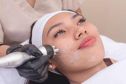 radiofrequence visage collagene .jpg