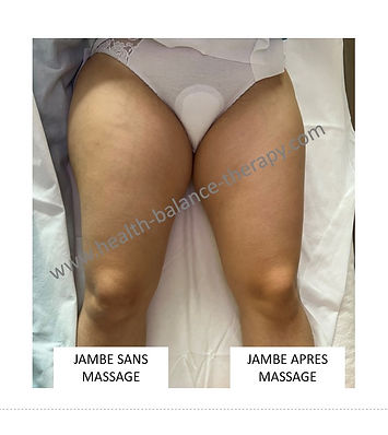 avant et apres massage anti cellulite gstaad.jpg