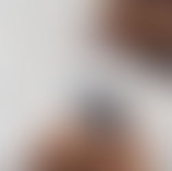 Keep Rats and Mice Out of the RV Engine - Ultrasonic Under Hood Animal Repeller – Easy Install