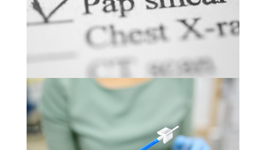 Tot ce trebuie să știi despre ASC-US, ASC-H, LSIL și HSIL: Ghid simplu și detaliat