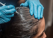 A blue gloved pair of hands are injecting a syringe into the head of a woman