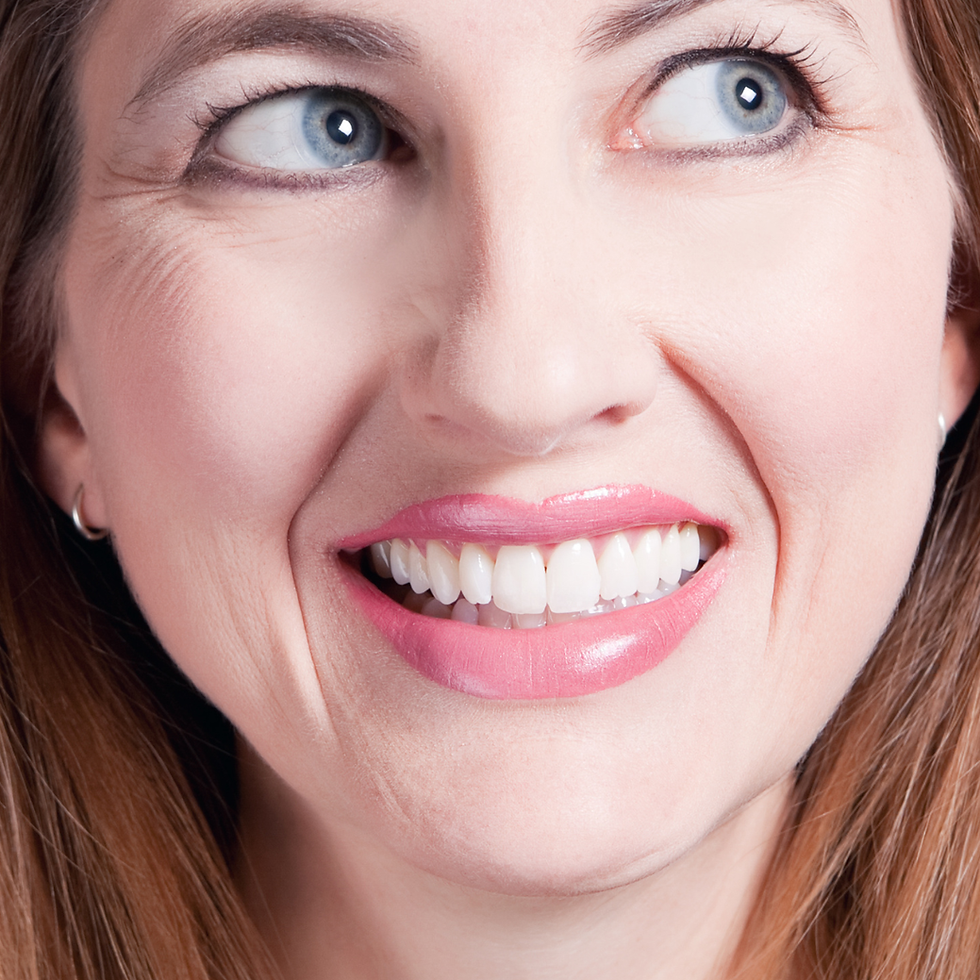 smile lines.png