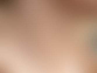 Permanent Skin Tag Removal