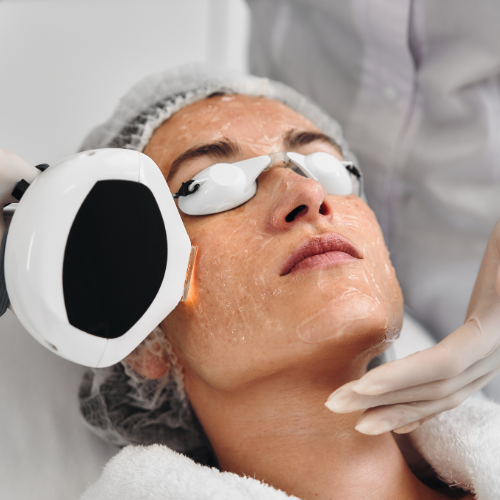 IPL Treatments1.png
